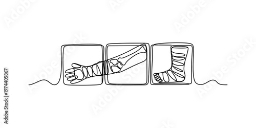 A single continuous line drawing of a bandaged human hand, forearm and a foot in square frames. Vector, illustration