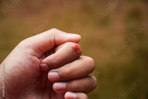 Фотография A close-up of a hand with a small cut on the fingertip showing fresh red blood against a blurred natural background emphasizing injury or minor trauma in an everyday context