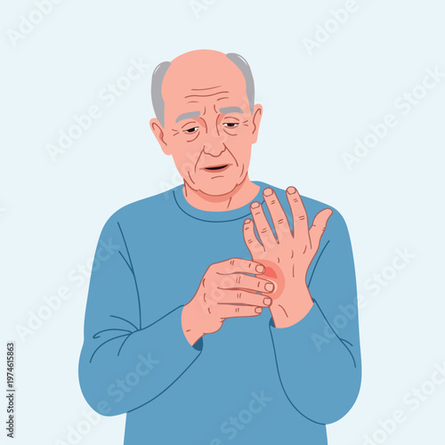 An elderly man holds his painful hand, showing a red patch of skin irritation