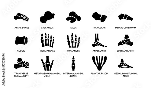 Foot anatomy diagrams: tarsal bones, metatarsals, joints, plantar fascia