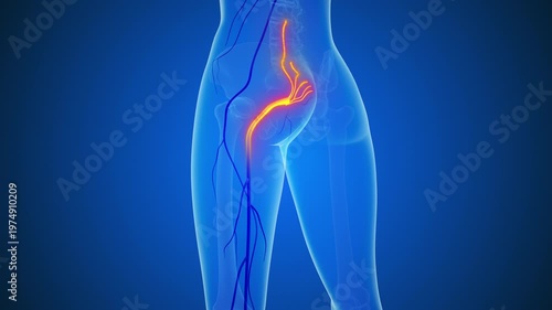 Sciatic Nerve Pain Spine Hip Leg