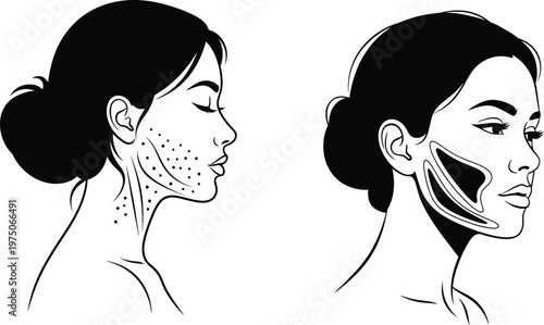 Facial muscle anatomy illustration side views showing superficial musculature