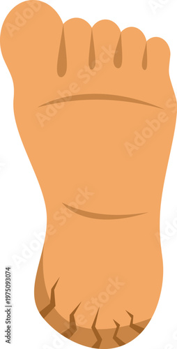 Vector illustration showing a human foot with dry, cracked heel on a white background