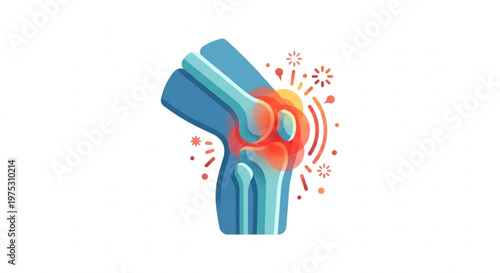 ​Flat 2.0 Joint Inflammation and Arthritis Vector Illustration with Red Pain Signal