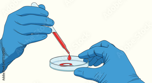 Close up view of hands wearing blue surgical gloves using a glass pipette to drop a red liquid sample into a petri dish for medical testing.