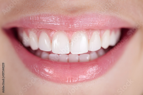 白く美しい歯と口元のクローズアップ（審美歯科・ホワイトニング）｜Close-up of clean white teeth and lips, dental aesthetics concept