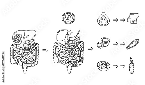 A detailed vector graphic illustration showing the digestive system and the effects of different foods on gut health