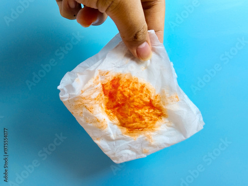 Foto Red-stained tissue in hand, indicating respiratory symptoms like bloody sputum;