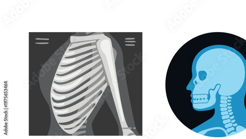 Human X-Ray Images Collection, Medical Radiology and Diagnostic Illustration