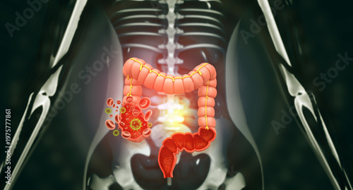 Detailed 3D anatomical model of the human colon and large intestine against a scientific background.