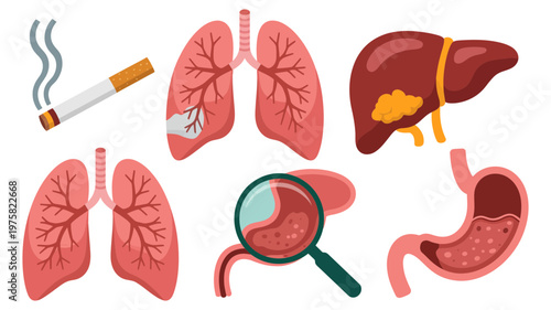 Comprehensive medical illustration depicting smoking's negative impact and various internal organ health issues.