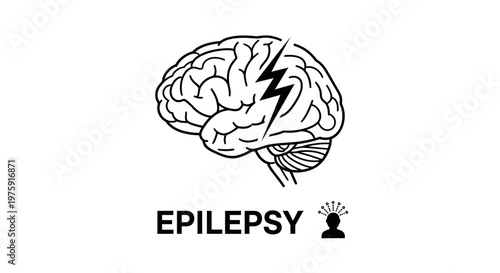 Vector illustration of a human brain with a lightning bolt symbol indicating an epileptic condition.