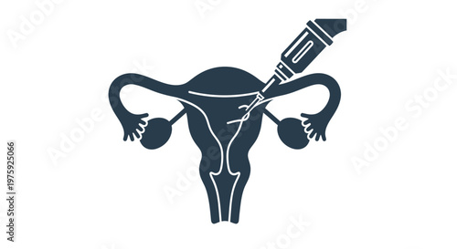 Gynecological surgery procedure icon on a human female reproductive system