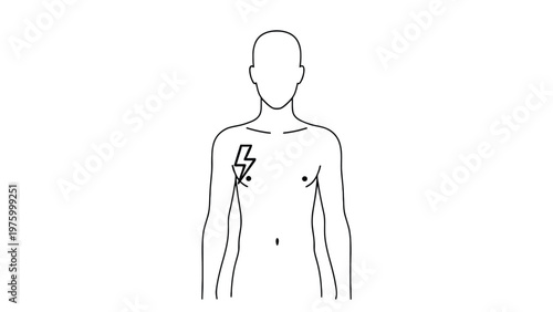 Minimalist vector illustration depicting a person's upper body with a stylized lightning bolt over the heart region, indicating medical alert or sudden energy.