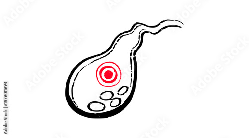 Human Gallbladder Disease