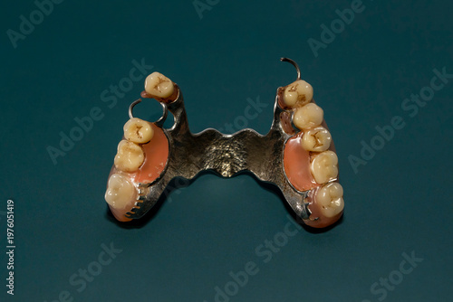 Removable partial denture with artificial teeth and metal base on dark green background. Studio macro photography isolated object. Dentistry and oral healthcare concept. Design for poster, banner.