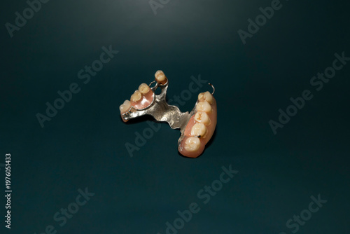 Removable partial denture with artificial teeth and metal base on dark green background. Studio macro photography isolated object. Dentistry and oral healthcare concept. Design for poster, banner.