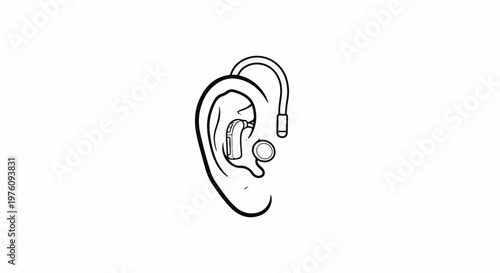 Line drawing of an ear with a hearing aid and earbud