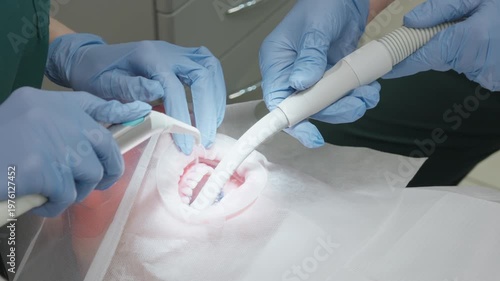 Professional dentist flushing blue plaque indicator from teeth with water spray using 3-way syringe while assistant using suction saliva ejector during oral hygiene treatment in clinic