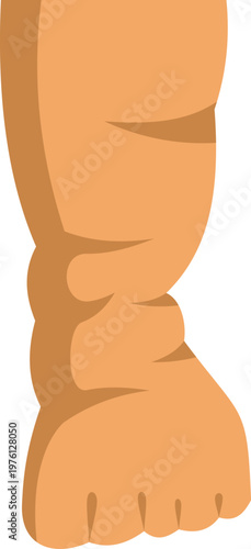 Human leg showing swelling and edema from a lymphatic system disease