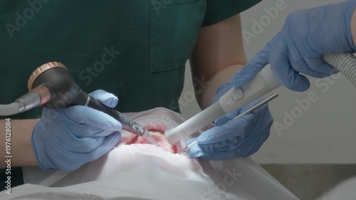 Stomatologist using professional air flow sandblasting technology for deep teeth cleaning and plaque removal. Intensive oral hygiene prophylaxis treatment in modern dental clinic cabinet