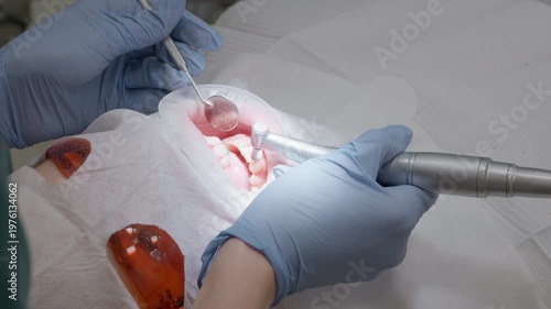 Dentist polishing teeth using professional rotating brush and abrasive paste for smooth enamel surface and brightening patient smile during hygiene procedure in stomatology clinic cabinet