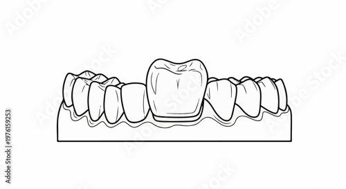 Dental anatomy illustration showing a row of teeth with a crown