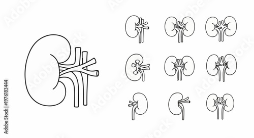 Schematic illustrations of human kidneys and their blood vessels