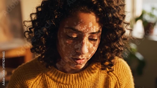 A serene woman with vitiligo enjoying a facial treatment at home.