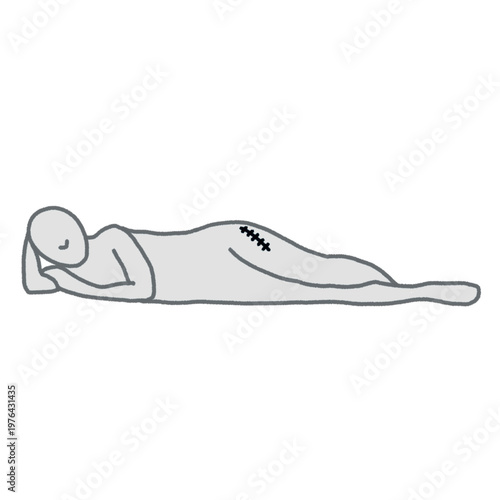 Photography incorrect way of lying down for people with a femur fracture