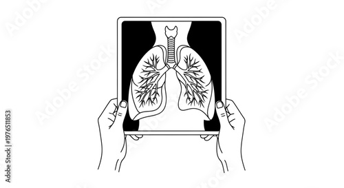 Hands Holding X-ray of Lungs and Trachea Illustration