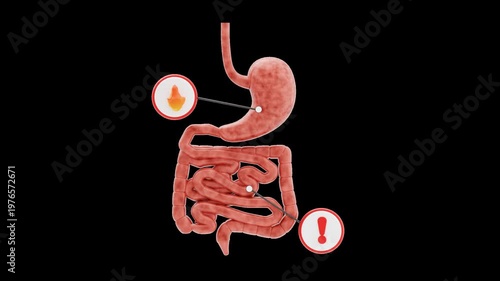 3D Acidity | Alpha Channel