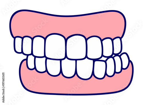 Crowded Teeth and Malocclusion, Irregular Bite Dental Alignment Problem