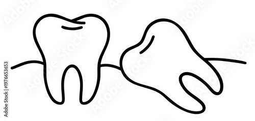 Impacted Wisdom Tooth Growing Horizontally Pressing Adjacent Tooth Dental Impaction Problem