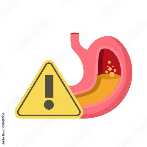 Creative illustration of stomach anatomy showing acid reflux, gastritis, or indigestion, highlighting digestive problems, medical warning, and alert for gastrointestinal health. flat illustration.
