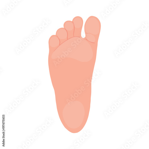 Diabetic Foot Ulcer Stages Medical Illustration
