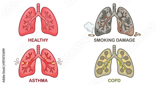 Comparing healthy lungs to those affected by smoking asthma and copd