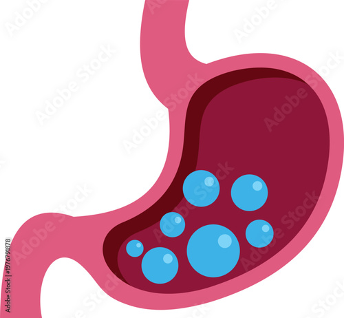 Human stomach organ with gas bubbles causing digestive discomfort