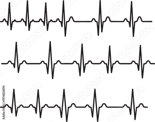 Three electrocardiogram heart rhythm lines in black on white background, also transparent background heartbeat