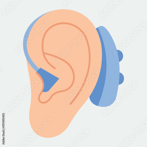 Hearing Aid: A clear illustration of an ear with a hearing aid attached, highlighting assistive technology and the concept of auditory assistance.