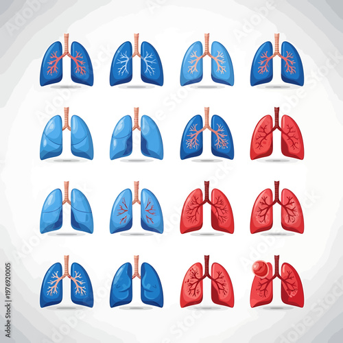 Hari Hipertensi Paru Sedunia Illustration Vector for Pulmonary Hypertension Awareness Day