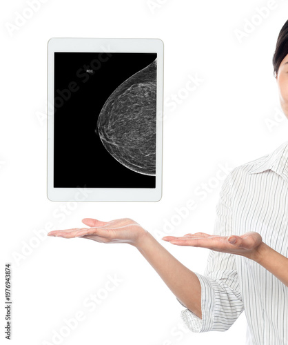 Female doctor holding digital tablet showing revealing benign calcifications and cysts (BI-RADS 2) result isolated on white background.