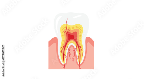 A detailed anatomical illustration displays the internal structure of a human molar including the enamel layer and vibrant red pulp nerves within the gum.
