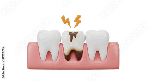 Vector illustration of 3d illustration of a decayed tooth with pain symbol on a transparent background