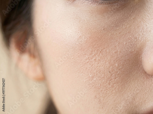 피부 비포 애프터 AI 피부개선 Skin Before After AI Skin Improvement