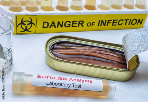 sample of tin cans, botulism infection in sick people, conceptual image