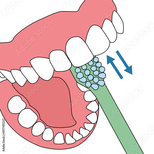 Vertical Brushing Technique for Inner Front Teeth Cleaning