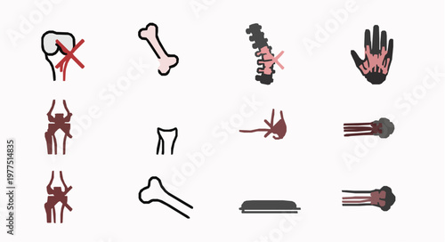 Fracture Movement Restriction Vector with Limited Joint Motion Icons