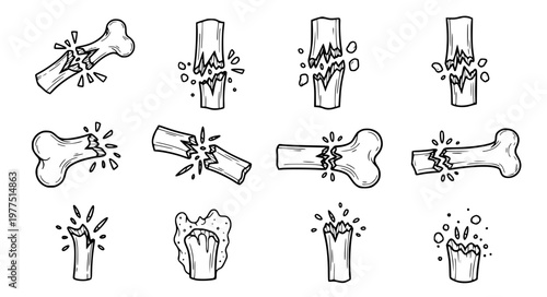 Bone Splinter Detail Vector with Fragmented Fracture Close Up