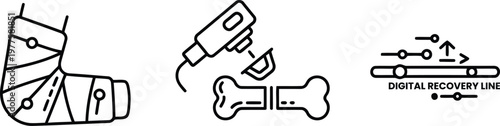 Vector of Orthopedic recovery icons set with leg cast bone fracture repair tool and digital recovery progress line